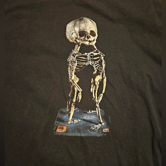 Black Mutter Museum Conjoined Twins Skeleton Shirt Size XL - Picture 1 of 5